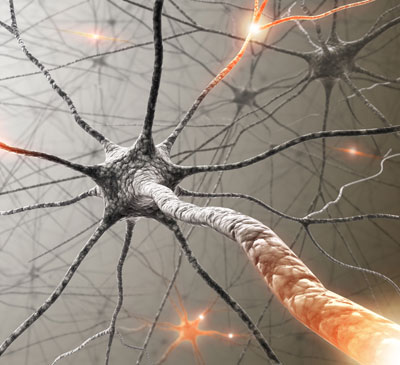 Global Guillain-Barré Syndrome Therapeutics Market 2019-2023